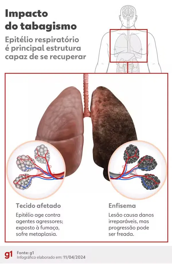 Apesar do impacto do tabagismo, pneumologista Elnara Negri alerta que parar de fumar sempre vale a pena, pois órgão têm boa capacidade de se recuperar das agressões